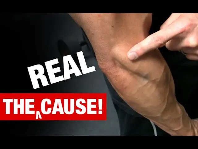 The Truth About Tennis Elbow (WHAT REALLY CAUSES IT!)