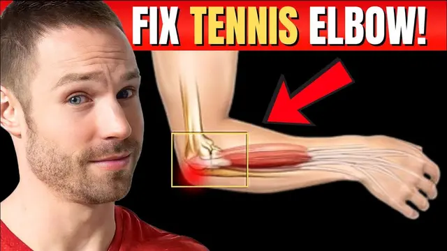 How to Fix Tennis Elbow FOREVER (No Surgery!)