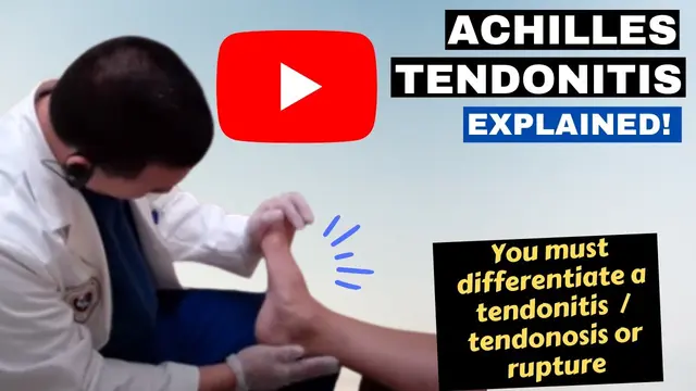 Achilles Tendonitis explained, Dr. Kevin Lam of NaplesPodiatrist.com