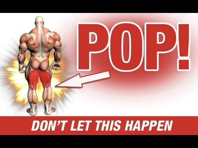 Hamstring Injury - Your ASS is to BLAME! (literally)