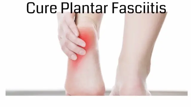 How I cured my plantar fasciitis- Running Tip 5