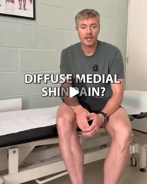 Shin splints